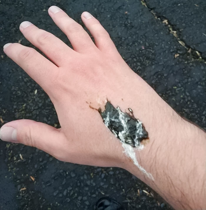 A Bird Just Pooped On My Hand As I Walked Down The Street
