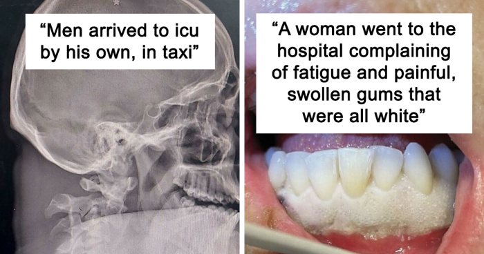 40 Bizarre And Inspiring Medical Cases That People Shared On This