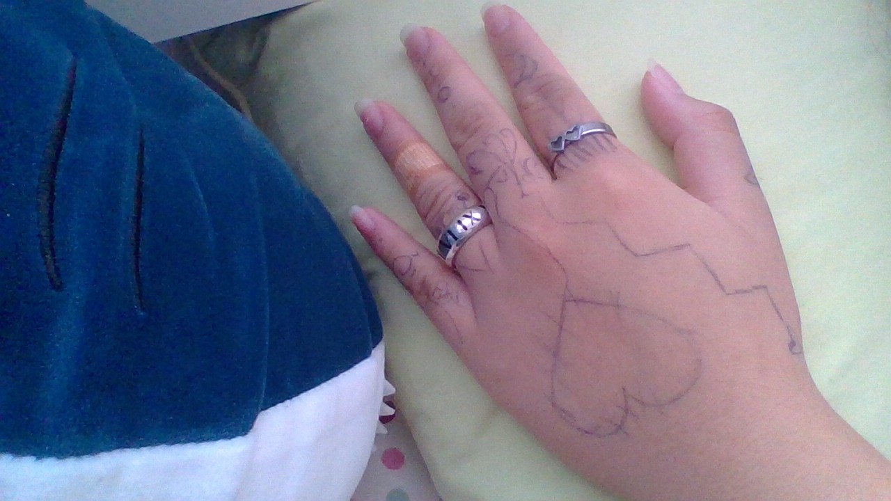 Hey Pandas, Show Us What You Did To Ur Hands