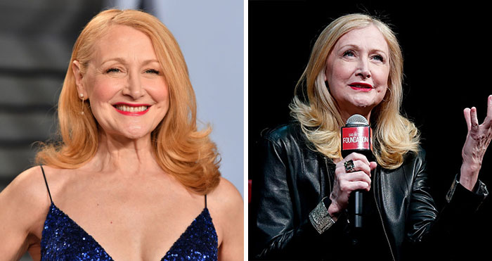 Patricia Clarkson Explains Why She Has Zero Regrets About Not Having Kids, The Reasons Are Brilliant