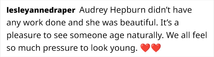 “I Have To Gulp Some Self-Acceptance”: 58-Year-Old Supermodel Opens Up About Ageing And Botox “I Have To Gulp Some Self-Acceptance”: 58-Year-Old Supermodel Opens Up About Ageing And Botox