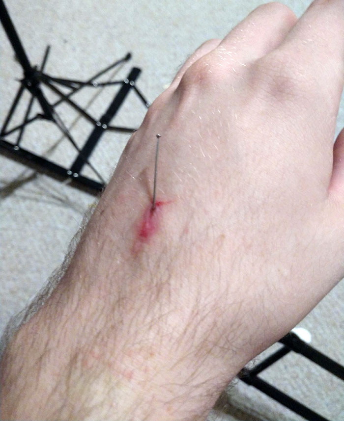 I Woke Up To A Sharp Pain In My Hand