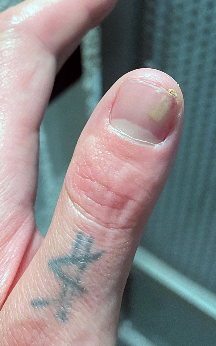 Got A Splinter Under My Thumbnail