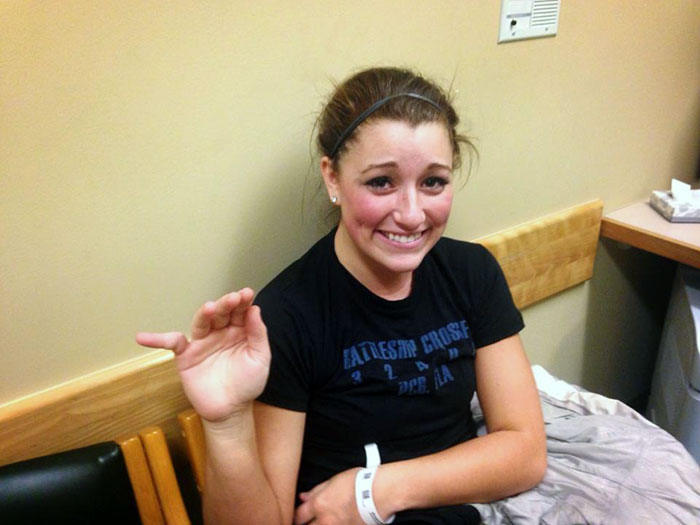 Mi compañera se ha roto un dedo jugando voleibol