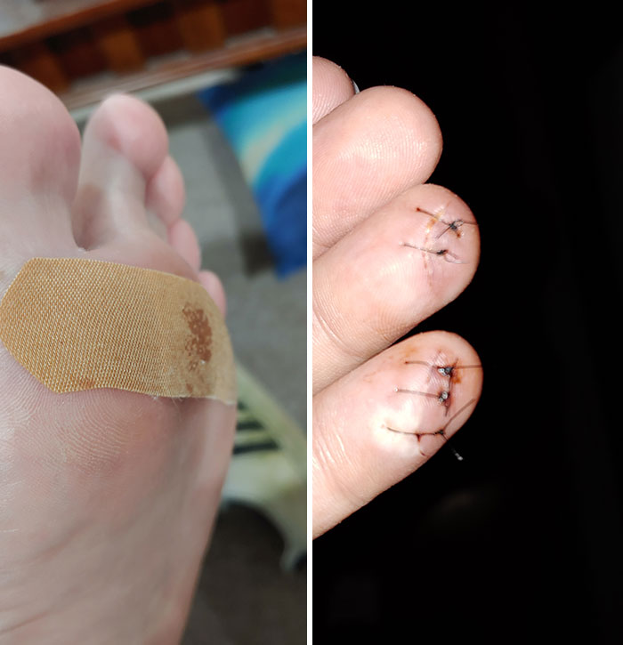 I Just Stepped On A Nail. Thankfully, I Didn't Need A Tetanus Shot. My Last One Was The Day After This Past Christmas When I Sliced A Couple Of My Fingers With A Box Cutter
