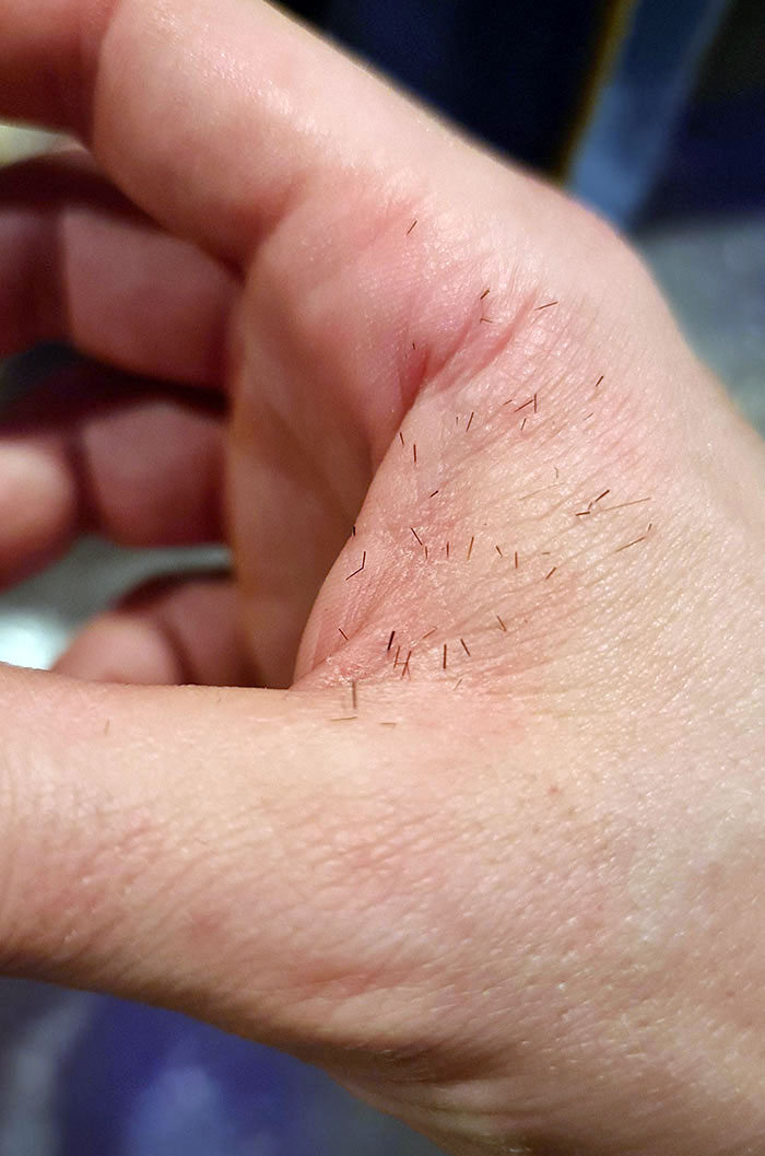 Trying To Catch A Cactus From Falling Over With 2 Hands. Other Hand Has Several Needles Buried In The Skin I Can't Get Out
