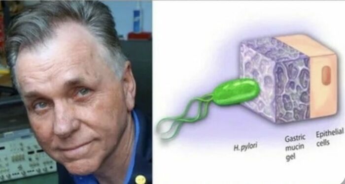 Barry Marshall Was Convinced That The Helicobacter Pylori Bacteria Caused Stomach Ulcers, But No One Believed Him