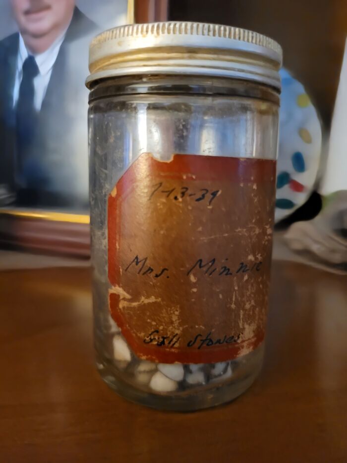 A Jar Of My Great Grandmother's Gall Stones