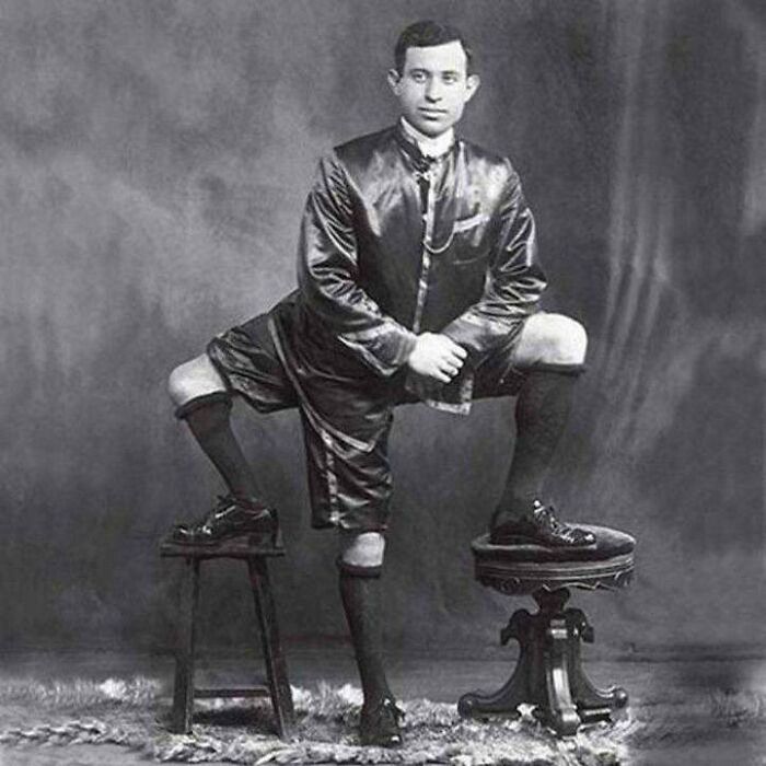 This Is Francesco Lentini, The 3 Legged Man. The Italian-American Circus Performer Was Born With 3 Legs, 4 Feet And 2 Sets Of Functioning Genitals. He Spent His Years Working For The Circus And Lived Until The Age Of 77