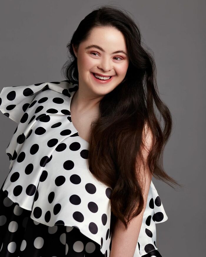 Woman With Down’s Who Was Given 0 Prospects At Birth Now Models For Gucci And Vogue Woman With Down’s Who Was Given 0 Prospects At Birth Now Models For Gucci And Vogue