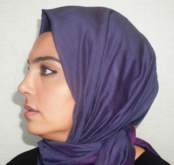 Before And After Photos From Turkish Plastic Surgery Clinic Have Left People Baffled Before And After Photos From Turkish Plastic Surgery Clinic Have Left People Baffled