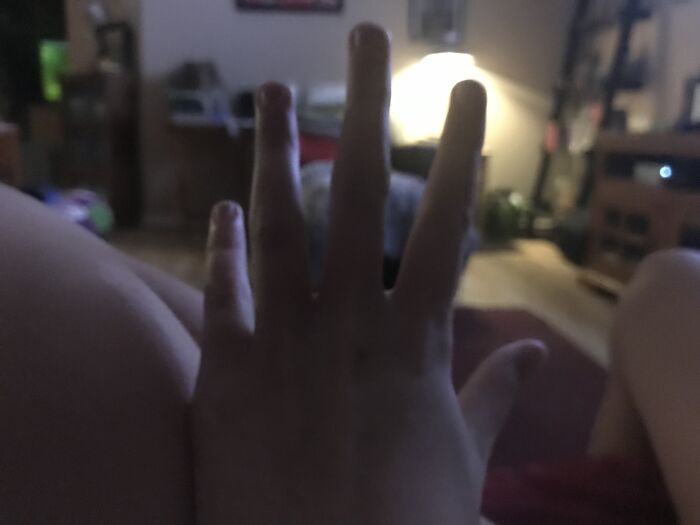 Sorry Couldn’t Get Any Good Lighting. My Nails Are Short Because I Bite Them During Stress