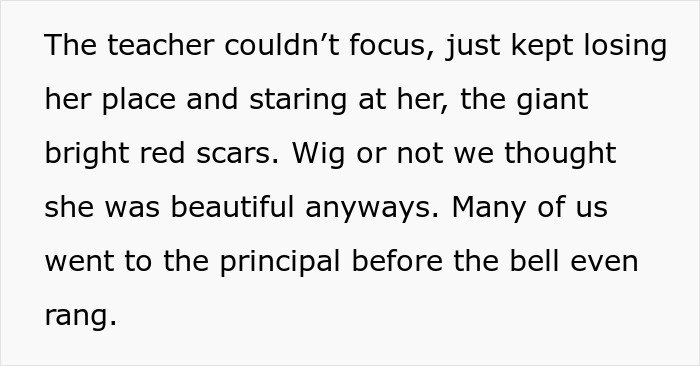 “Smiled, Took It Off”: Student Maliciously Complies, Takes Off Her Wig As Per Teacher's Demands “Smiled, Took It Off”: Student Maliciously Complies, Takes Off Her Wig As Per Teacher's Demands