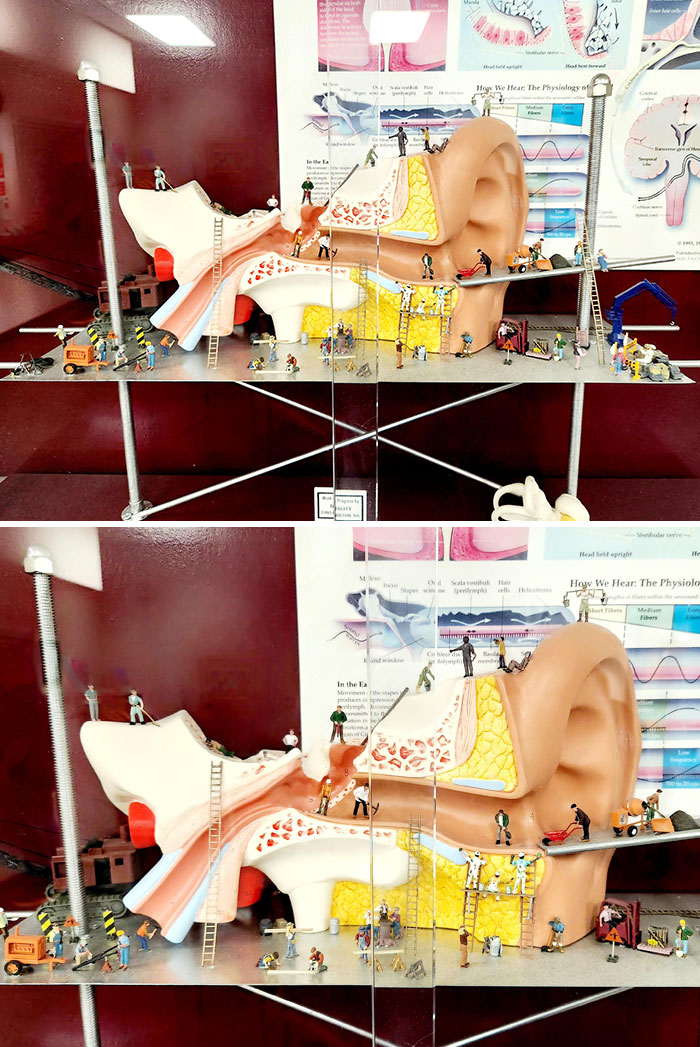 Ear Anatomy Model With Miniature Construction Crew At The ENT Office
