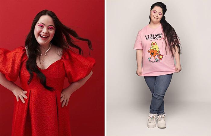Woman With Down’s Who Was Given 0 Prospects At Birth Now Models For Gucci And Vogue
