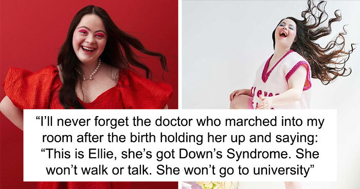 Woman With Down’s Who Was Given 0 Prospects At Birth Now Models For Gucci And Vogue