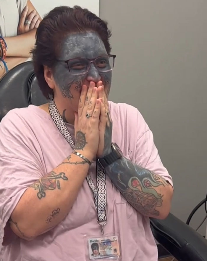 Woman Whose Face Was Tattooed Against Her Will Gets Removal Surgery Thanks To A Kind Stranger