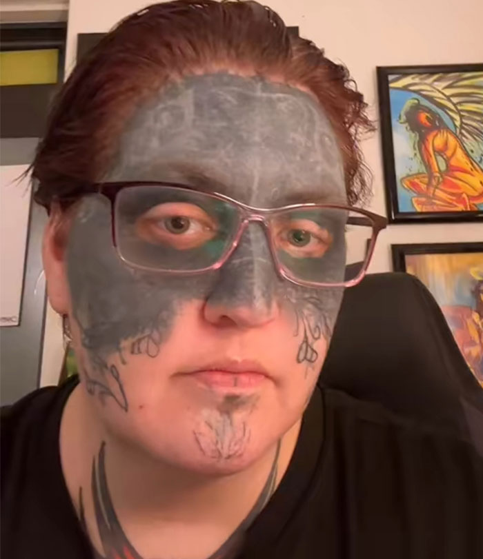 Woman Whose Face Was Tattooed Against Her Will Gets Removal Surgery Thanks To A Kind Stranger