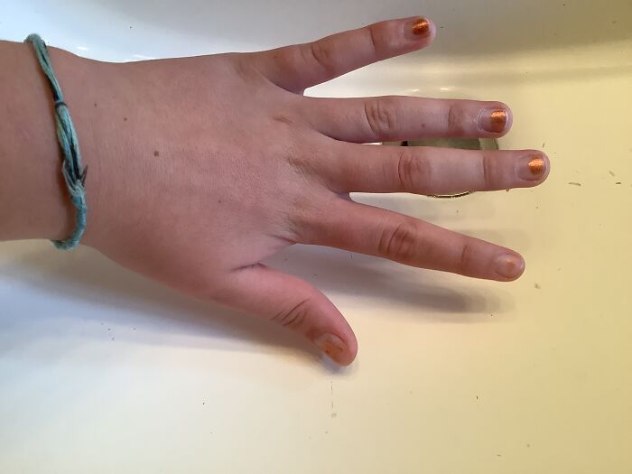 Why Does My Hand Look Weird? Nails Were Painted A While Ago By Some 4th And 5th Grade Neighbors