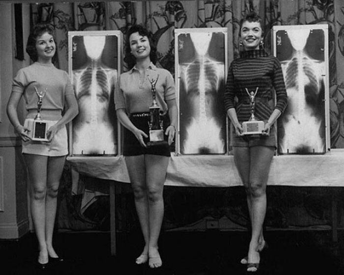 Ganadoras del concurso Miss Postura Perfecta en una convención de quiroprácticos, 1956