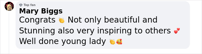 Woman With Down’s Who Was Given 0 Prospects At Birth Now Models For Gucci And Vogue Woman With Down’s Who Was Given 0 Prospects At Birth Now Models For Gucci And Vogue