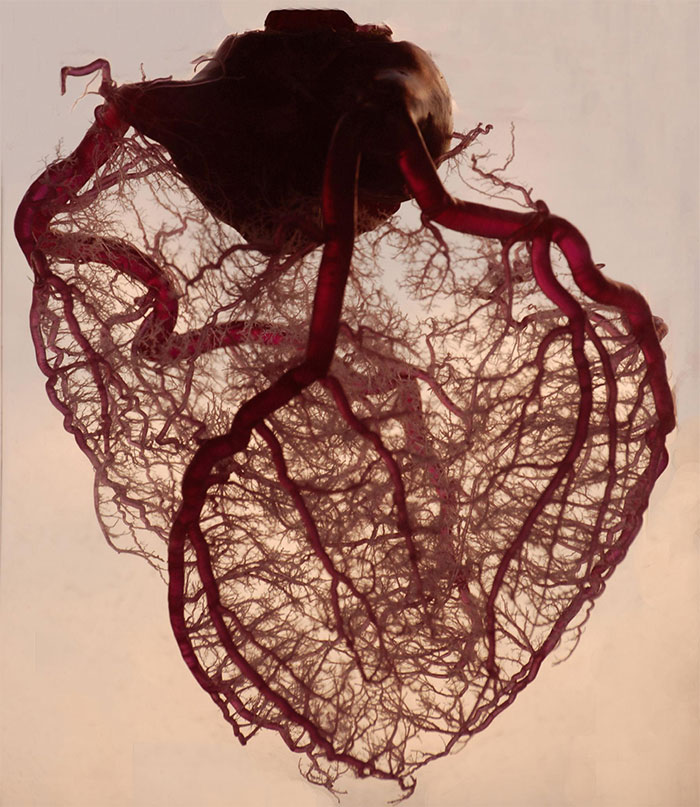 The Human Heart Stripped Of All Fat And Muscle, With Just The Coronary Arteries And Cardiac Veins Exposed