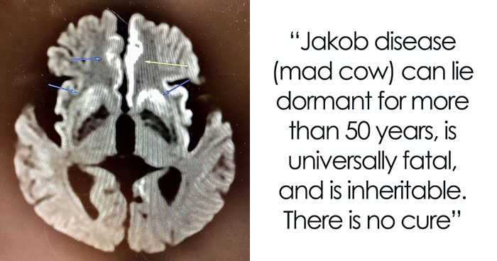 People Share 30 “Genuinely Terrifying” Facts