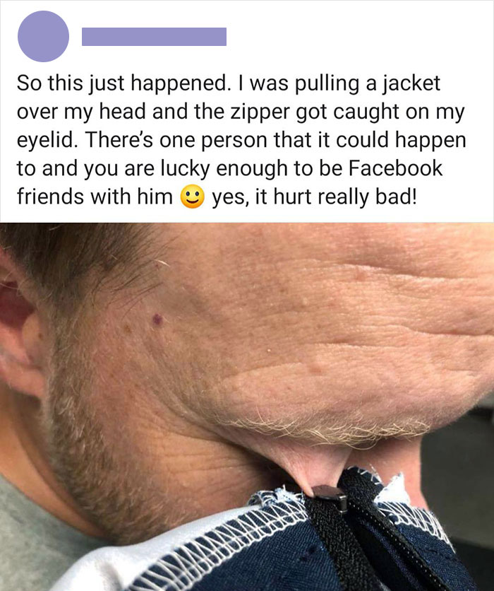 Eyelid Somehow Got Stuck In The Zipper Of His Jacket