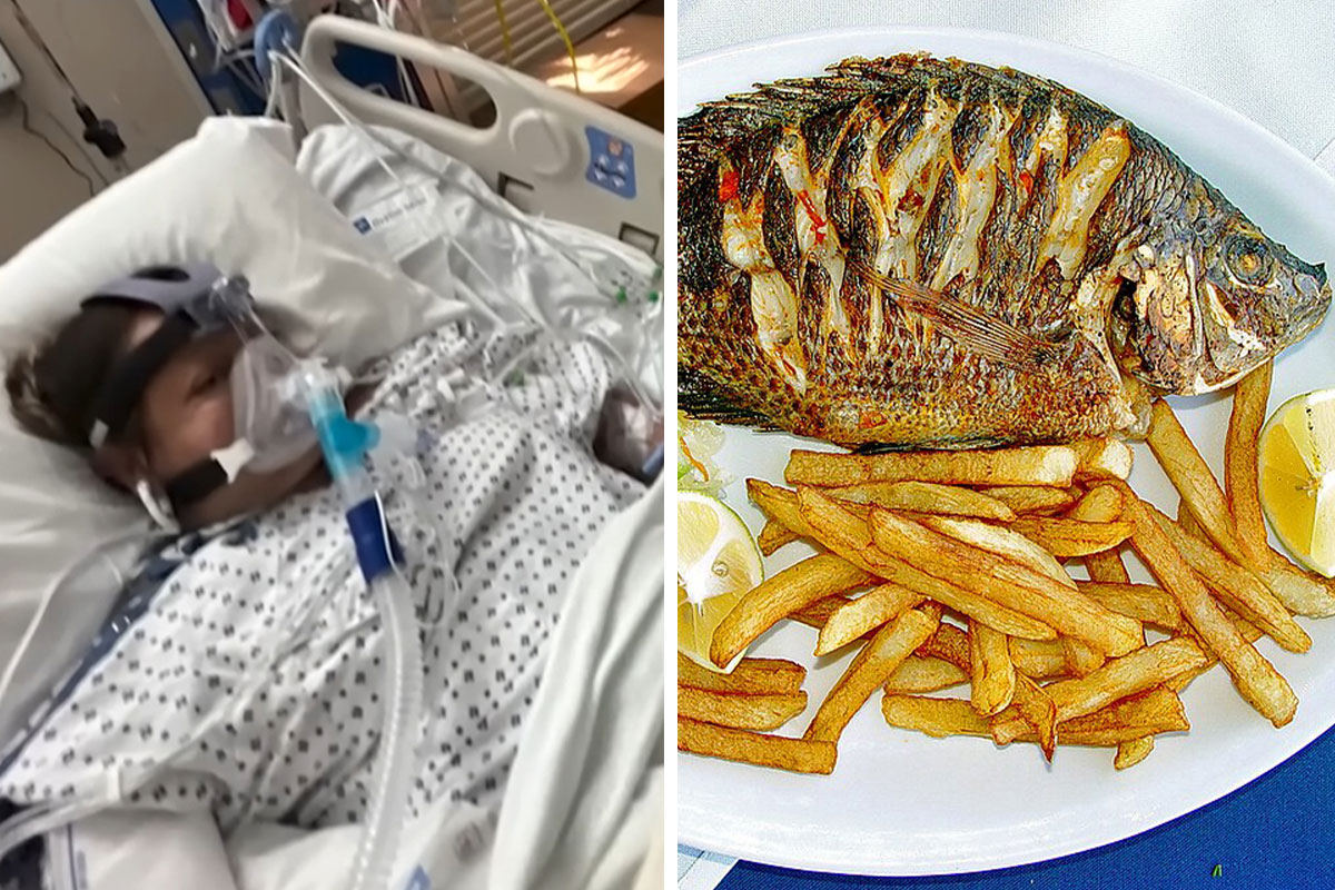 California woman has all four limbs amputated after eating bad tilapia