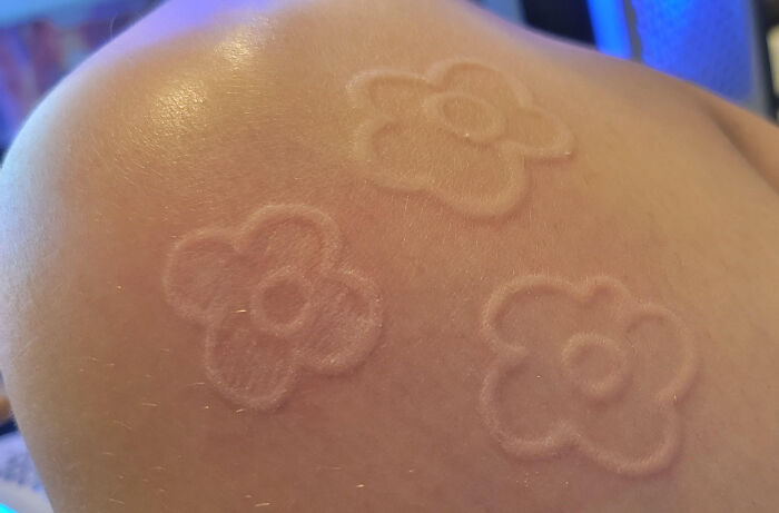 50 Things People Thought Were 'Normal' About Their Bodies Until They Realized They Weren't