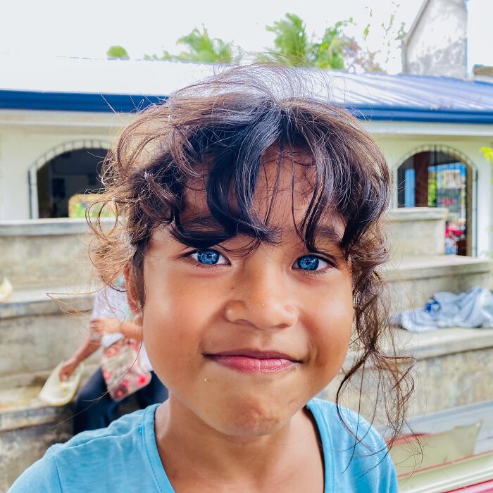 Girl In The Philippines Has A Genetic Mutation Of Blue Eyes