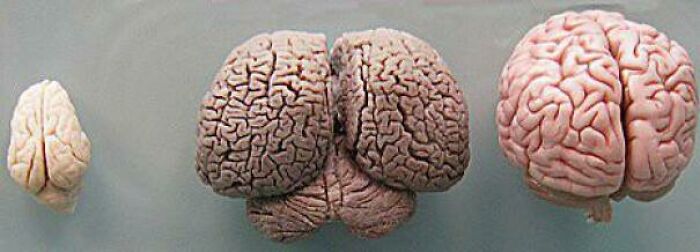 The Brain Of Common Bottlenose Dolphin (Middle) A Human Brain (Right) And A Wild Boar (Left)