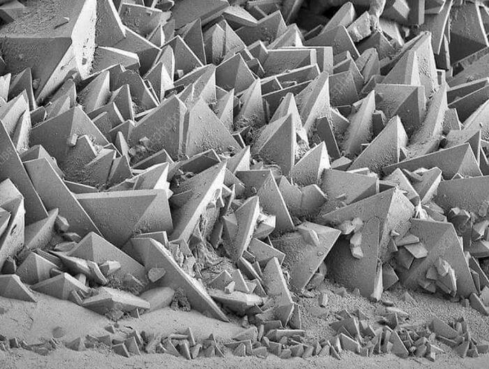 Kidney Stones Under An Electron Microscope