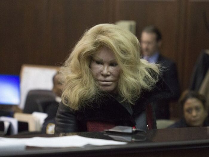 This Is Jocelyn Wildenstein, The Wealthy Socialite Nicknamed “Bride Of Wildenstein” And “Catwoman” Because Of Her Extreme Plastic Surgery