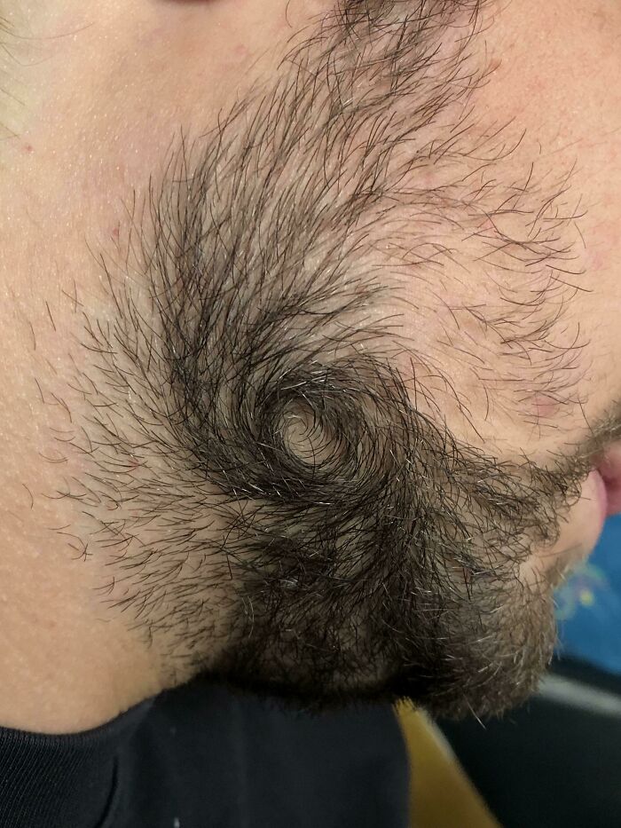 My Boyfriends Beard Hair Grows In Like A Hurricane Pattern