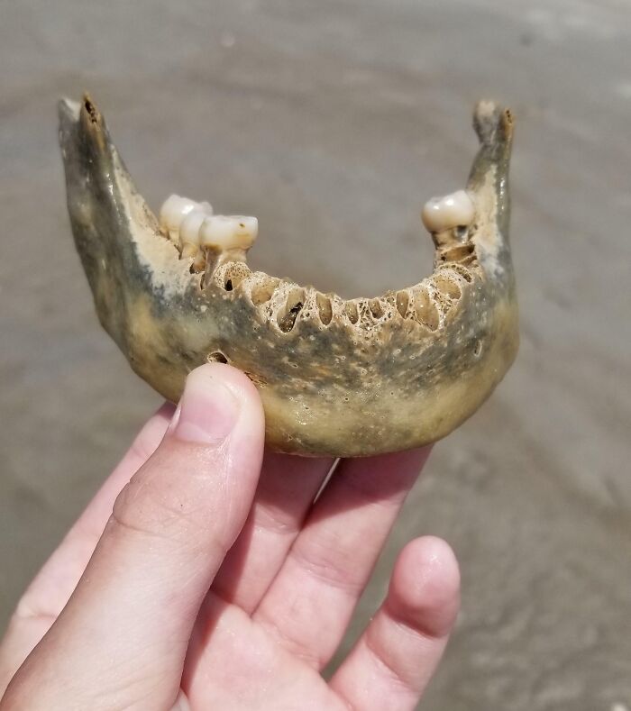 I Found What Appears To Be A Human Jaw With Teeth At The Point In Emerald Isles
