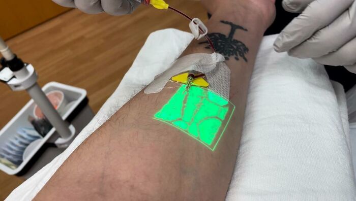 Nurse Used An Infrared Vein Finder Today To Place An IV