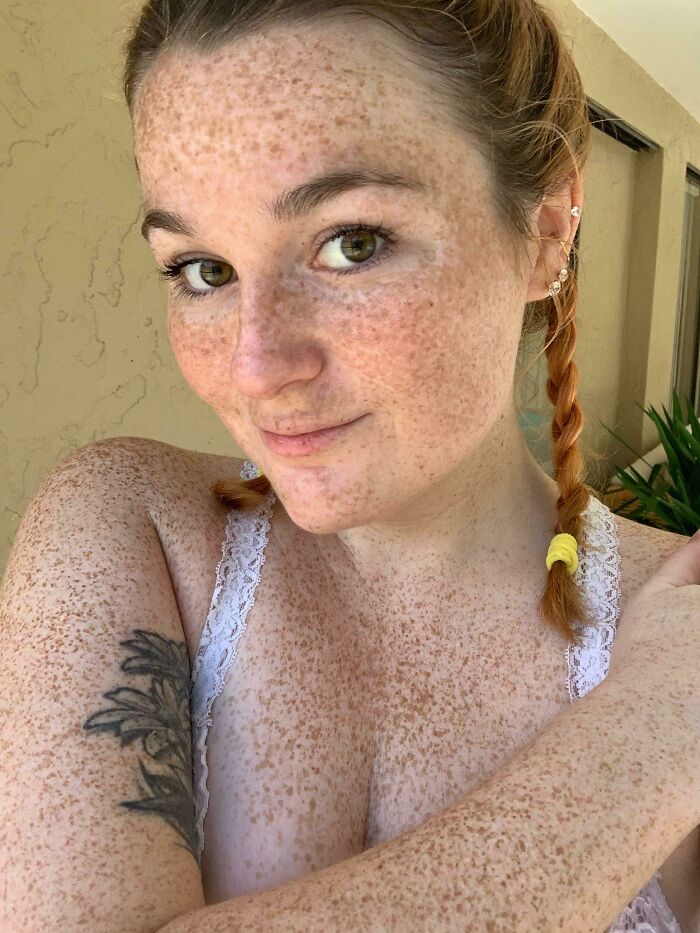 I Think I Get New Freckles Every Day