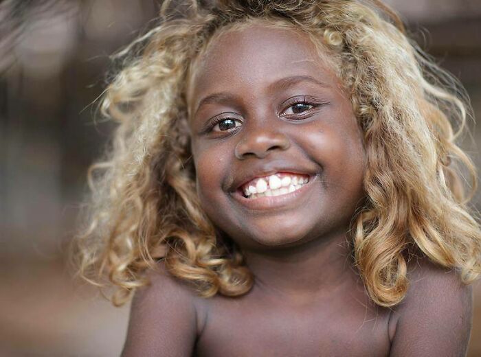 A Native Group Of People Living On The Soloman Islands Northeast Of Australia Called Melanesians Is Famous For Their Beautiful Dark Skin And Naturally Blonde Hair