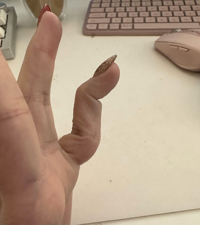I Have A "Hitchhiker's" Ring Finger And Can Bend The Joints Separately