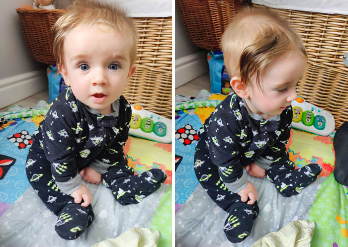 My Son's Birthmark Gives Him The Best Hairstyle