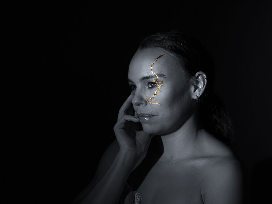 Kintsugi Beauty: Celebrating The Beauty Of Scars And Imperfections In Photography