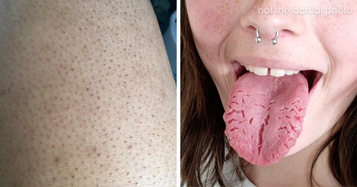 50 Things People Thought Were ‘Normal’ About Their Bodies Until They Realized They Weren’t