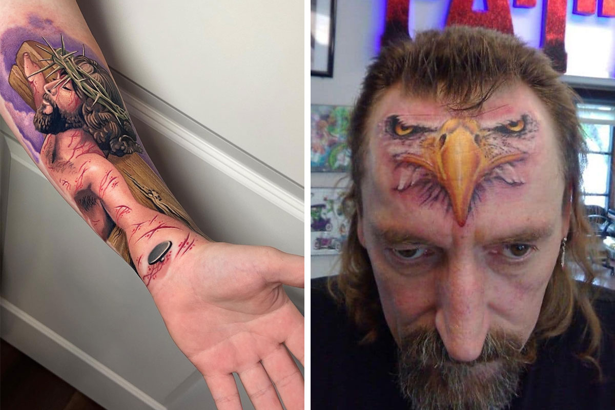 Can you get rid of face tattoos with laser tattoo removal?