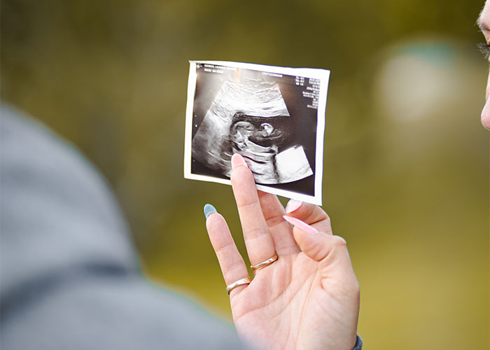 Guy Breaks Up With GF Of 3 Months Because She's Pregnant And He Doesn't Want To Be A Dad Guy Breaks Up With GF Of 3 Months Because She's Pregnant And He Doesn't Want To Be A Dad