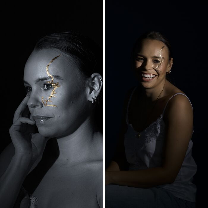 Kintsugi Beauty: Celebrating The Beauty Of Scars And Imperfections In Photography