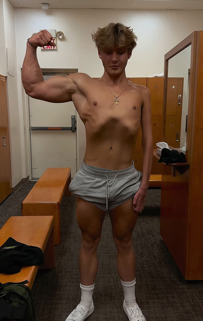 19-Year-Old Stuns People Online After Revealing Reason Why Right Arm Bigger Than His Left 19-Year-Old Stuns People Online After Revealing Reason Why Right Arm Bigger Than His Left