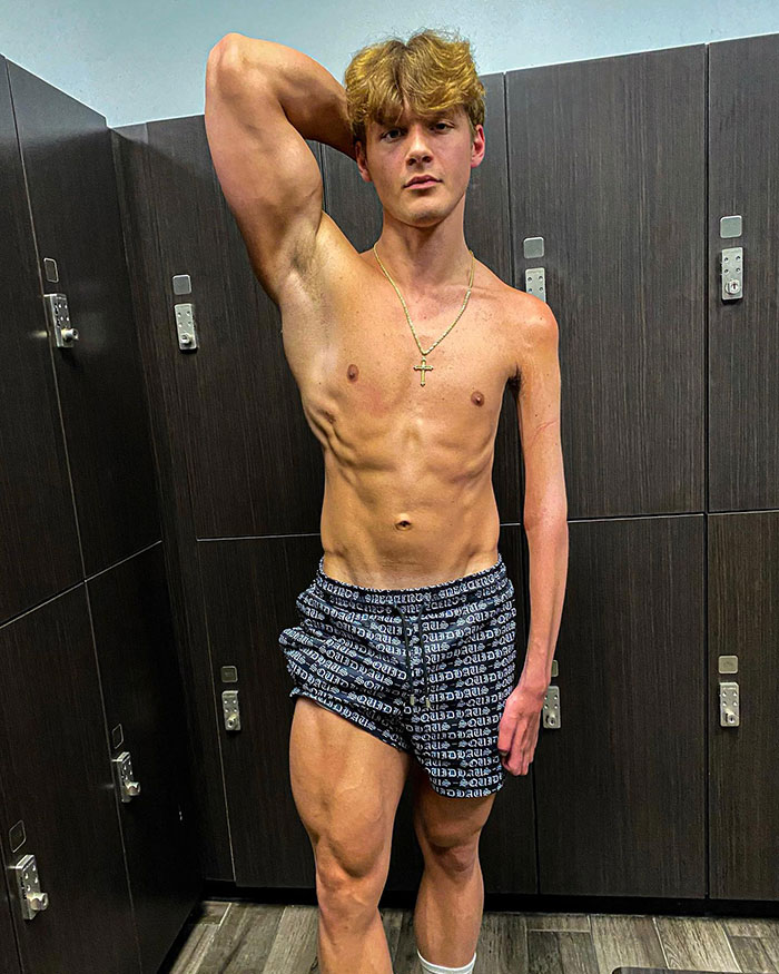 19-Year-Old Stuns People Online After Revealing Reason Why Right Arm Bigger Than His Left 19-Year-Old Stuns People Online After Revealing Reason Why Right Arm Bigger Than His Left