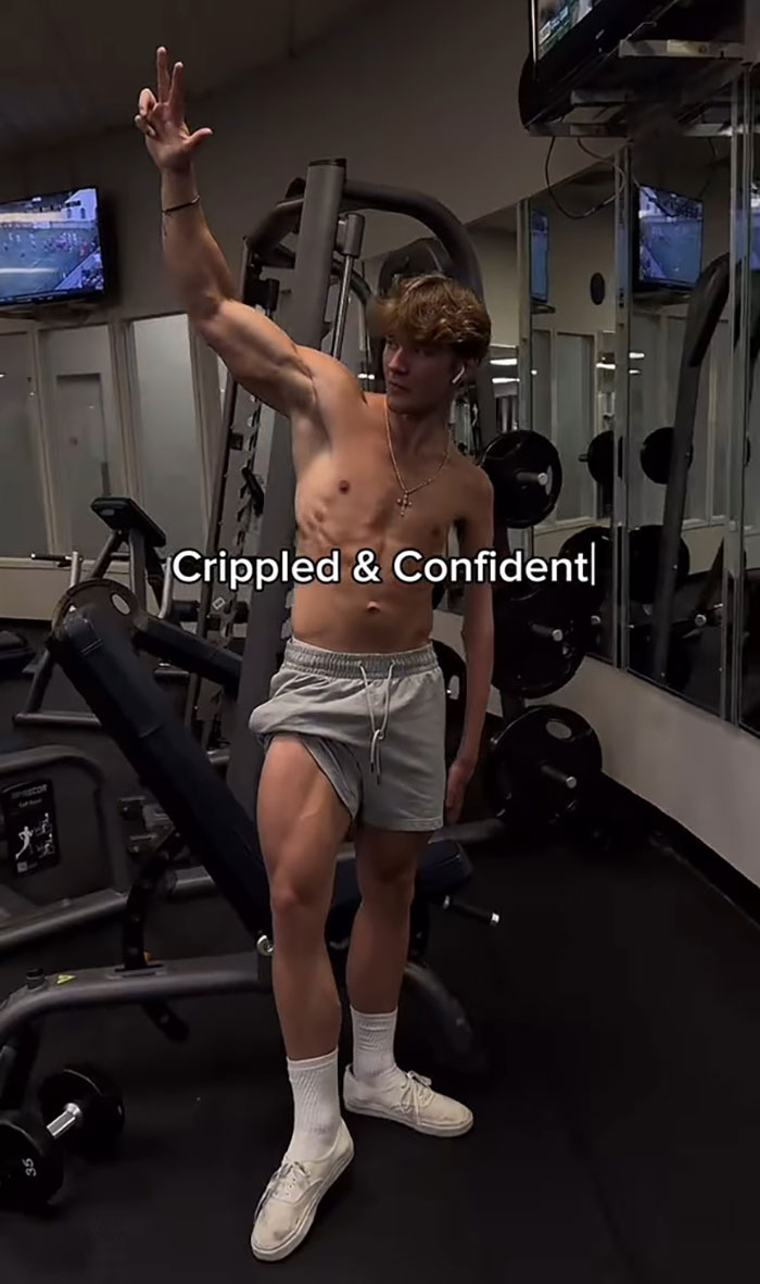 19-Year-Old Stuns People Online After Revealing Reason Why Right Arm Bigger Than His Left 19-Year-Old Stuns People Online After Revealing Reason Why Right Arm Bigger Than His Left