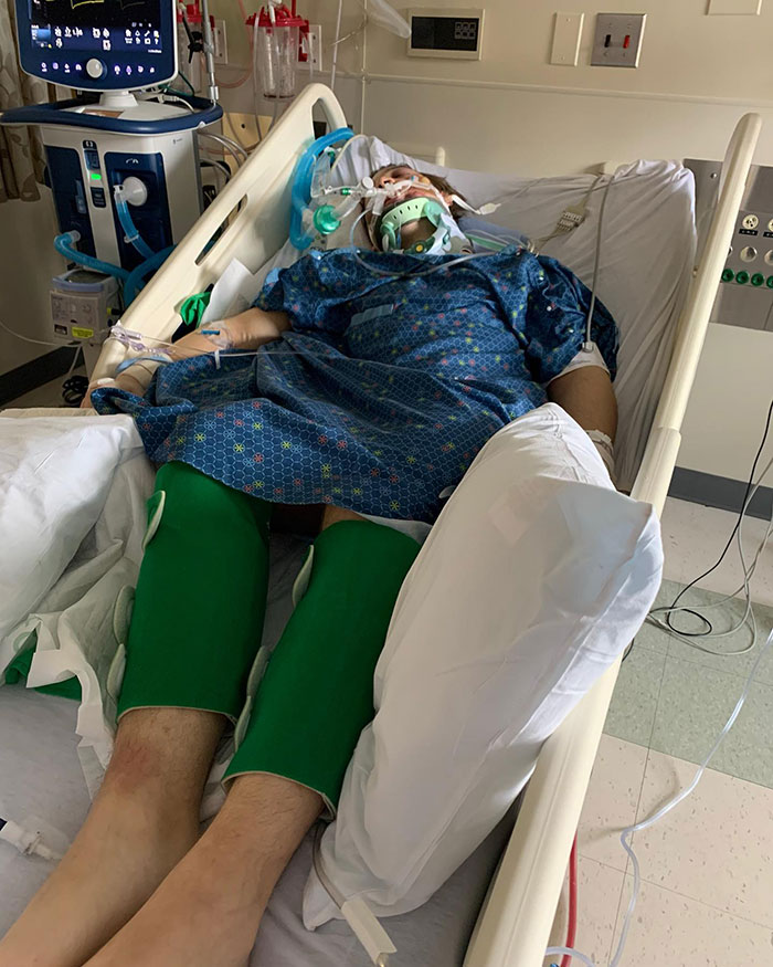 19-Year-Old Stuns People Online After Revealing Reason Why Right Arm Bigger Than His Left 19-Year-Old Stuns People Online After Revealing Reason Why Right Arm Bigger Than His Left